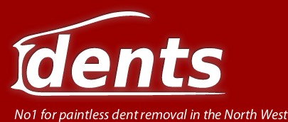 Dents